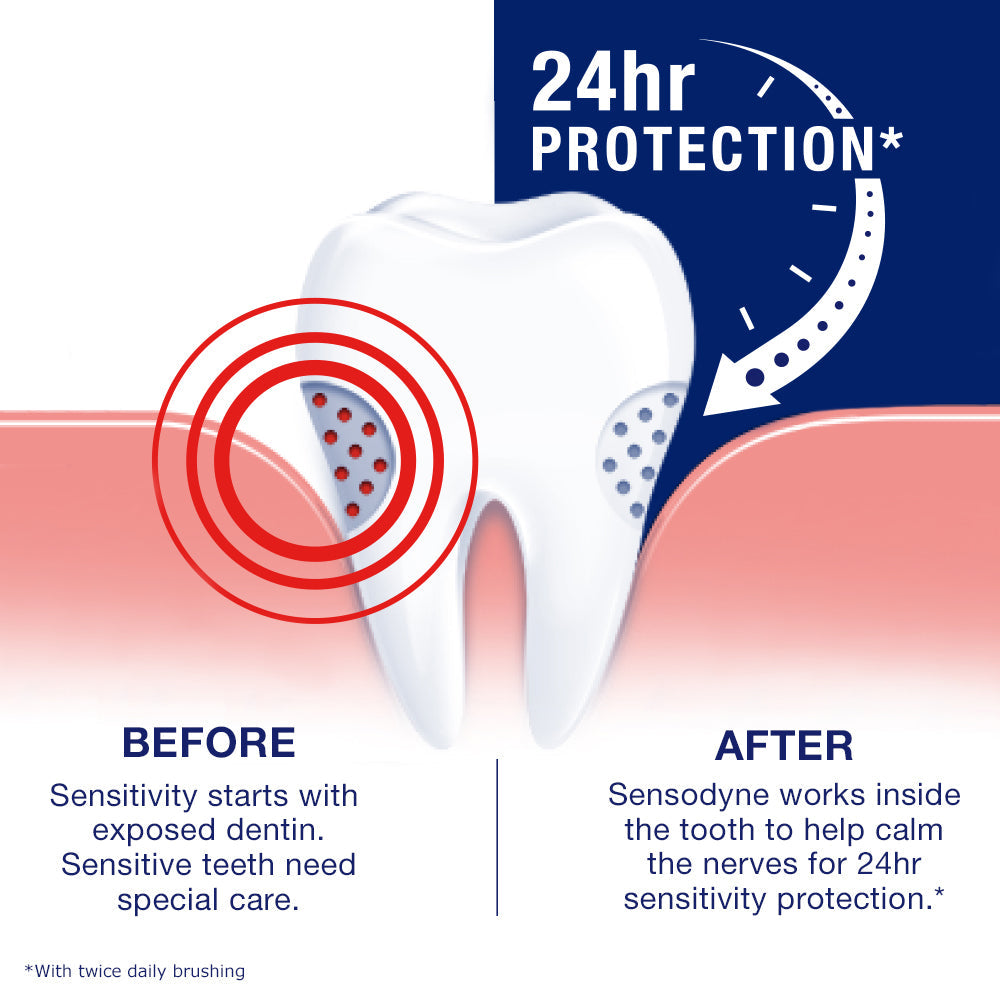 Pasta de dente para sensibilidade Sensodyne, clareamento extra, para dentes sensíveis, proteção 24 horas por dia, 7 dias por semana, 4 onças (pacote com 2)